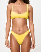 Yellow Scalloped Edge Bikini Bottom