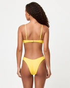 Yellow Scalloped Edge Bikini Bottom